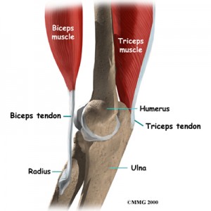 Triceps Brachii Tendon Rupture | 👨‍⚕️Singapore Orthopaedic ...